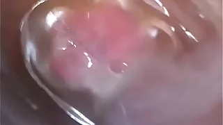 Internal view of me Fucking and cuming in my new Fleshlight Ice Lady